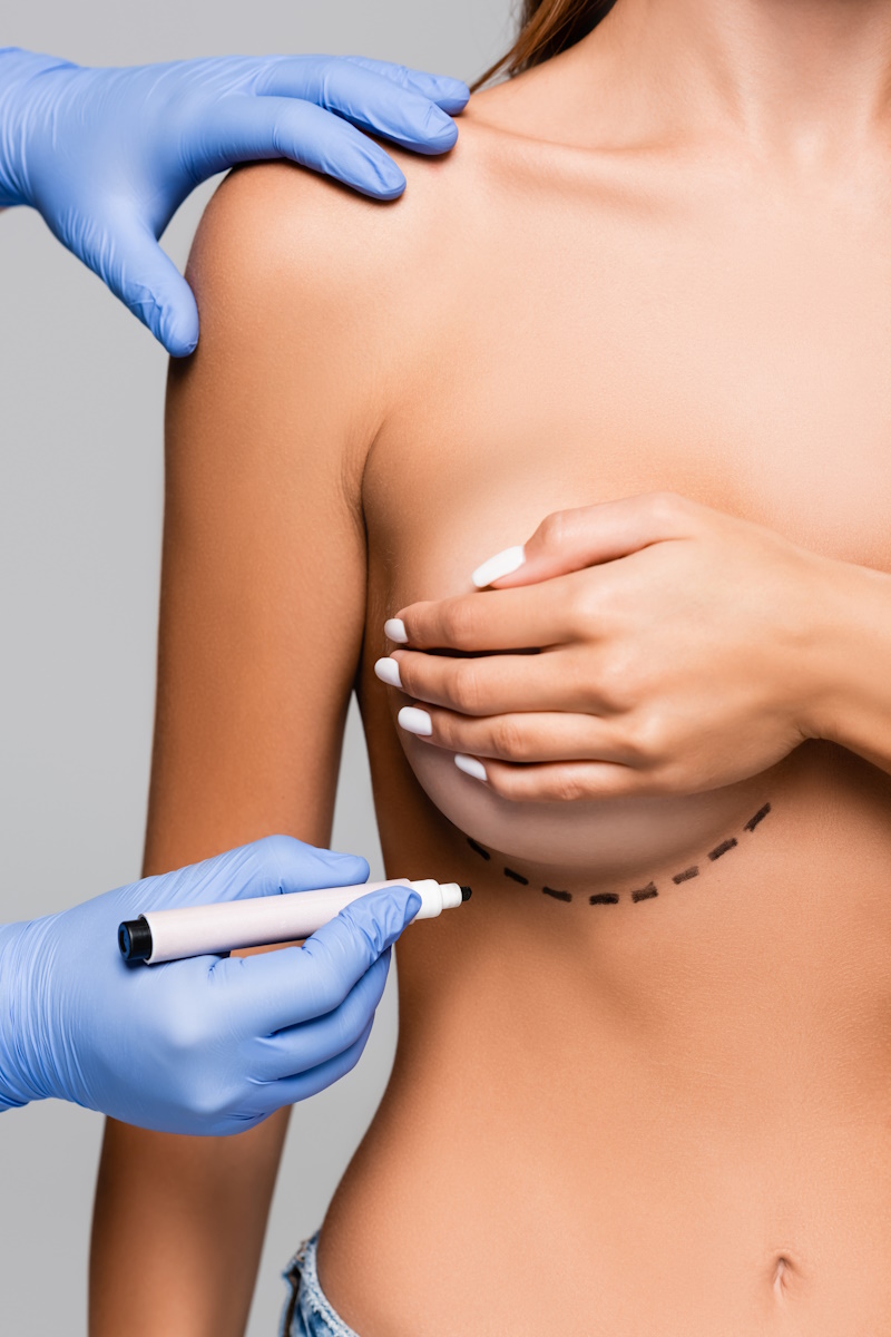 Cropped view of plastic surgeon holding marker near breast of young woman isolated on grey