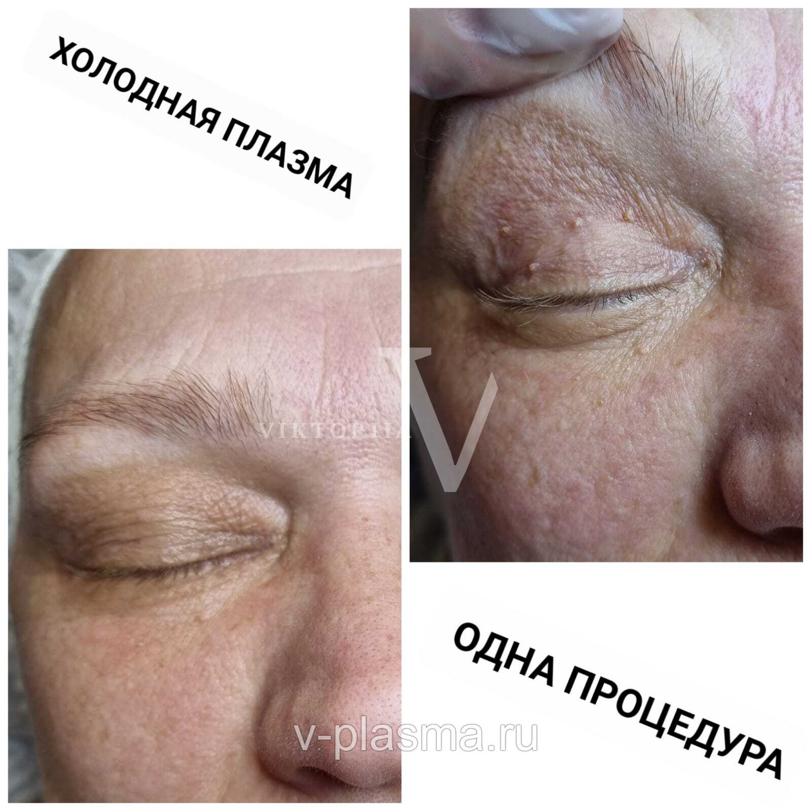 Изображение WhatsApp 2023-11-29 в 12.41.17_40be16fa